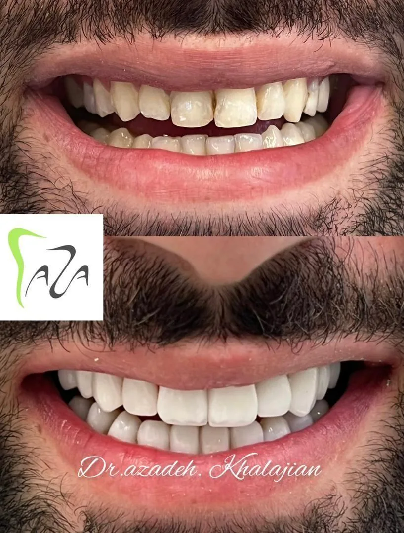 دندانپزشکی دکتر آزاده خلجیان - تصویر 2