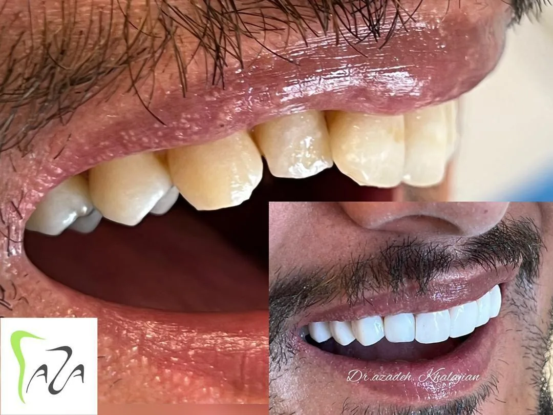 دندانپزشکی دکتر آزاده خلجیان - تصویر 3