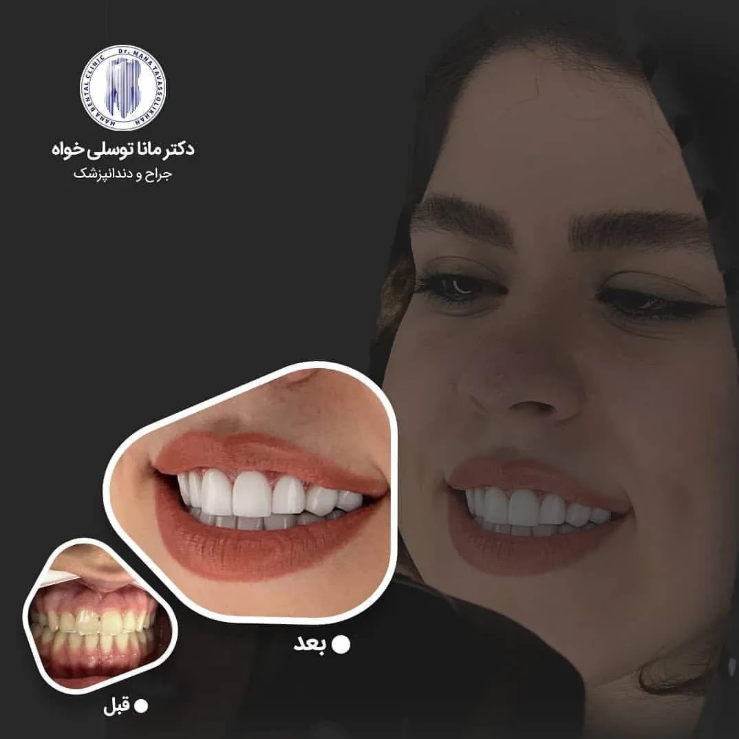 دندانپزشکی دکتر مانا توسلی خواه - تصویر 2