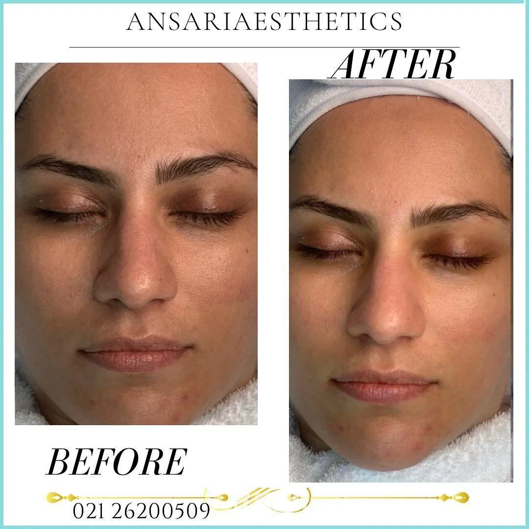 کلینیک پوست،مو و زیبایی انصاری و دکتر سارا ذوالقدر