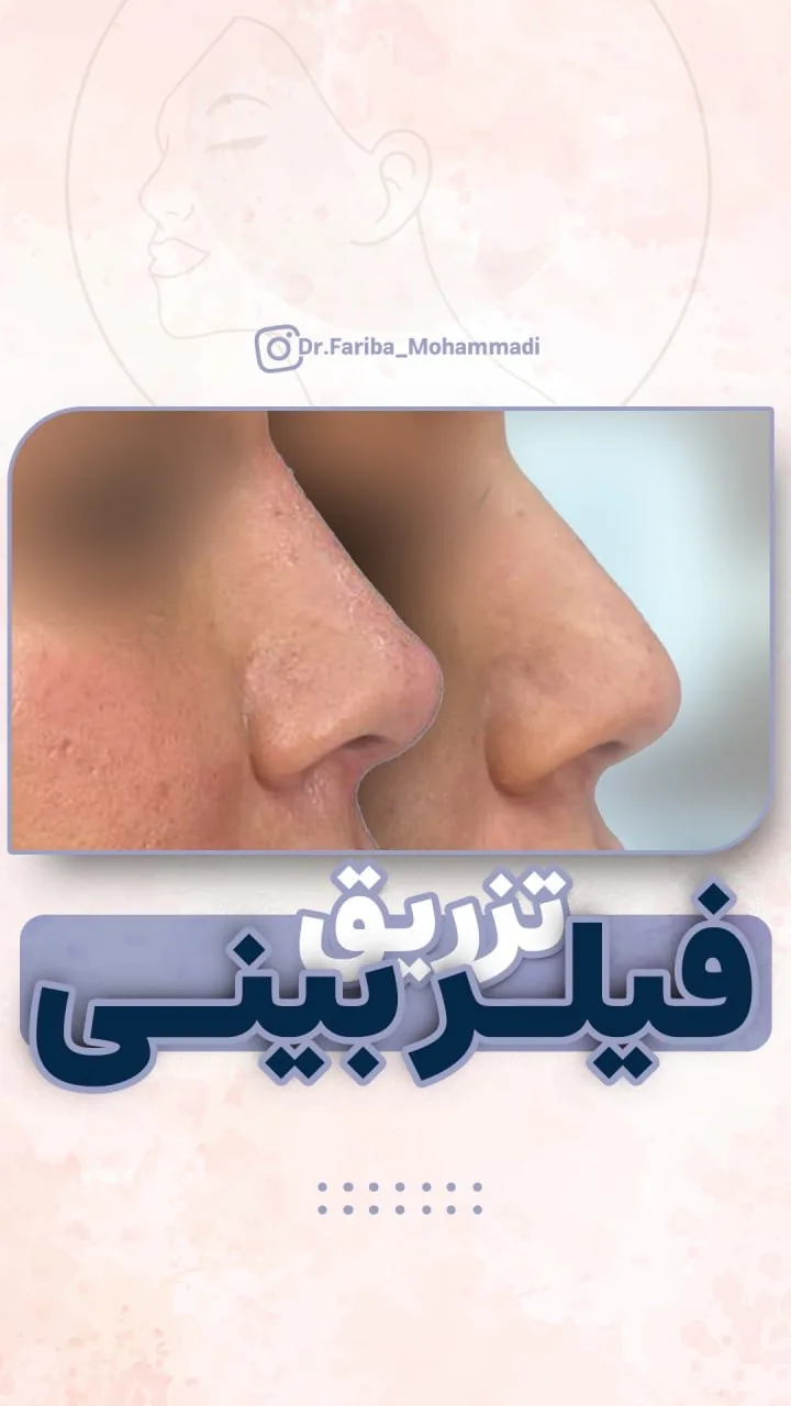 مرکز پوست ،مو و زیبایی دکتر فریبا محمدی - تصویر 2