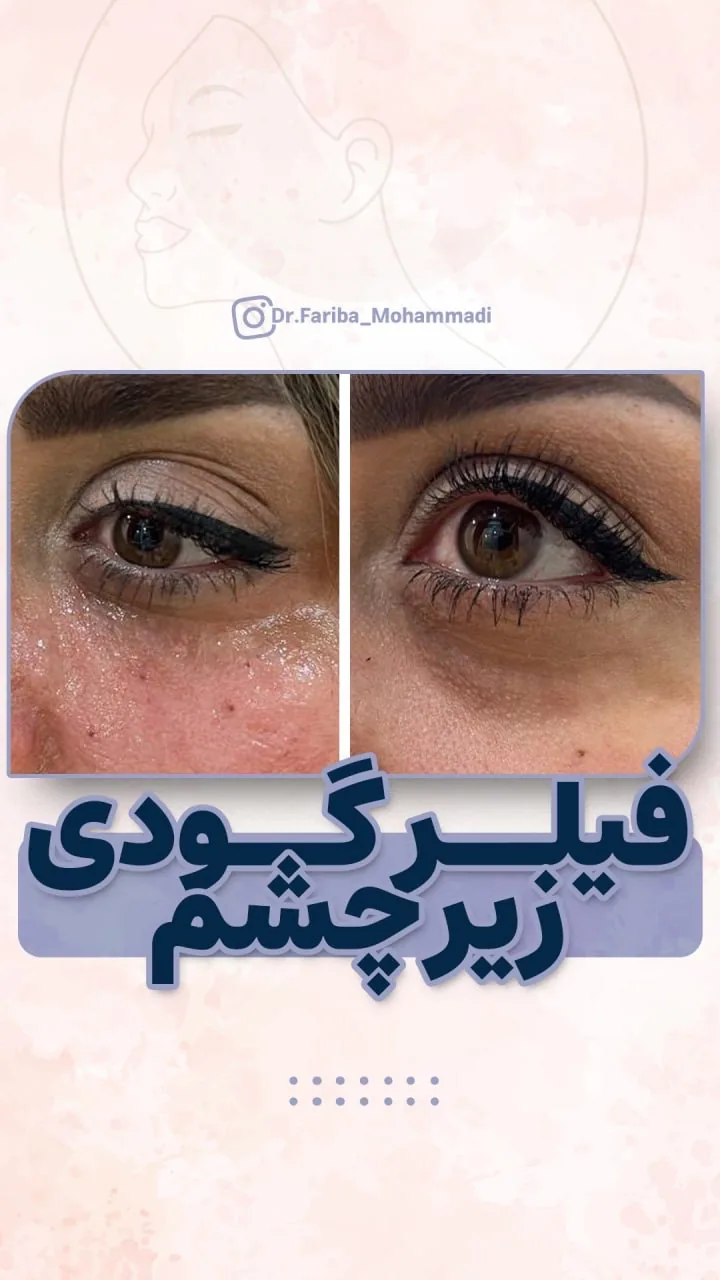 مرکز پوست ،مو و زیبایی دکتر فریبا محمدی - تصویر 3