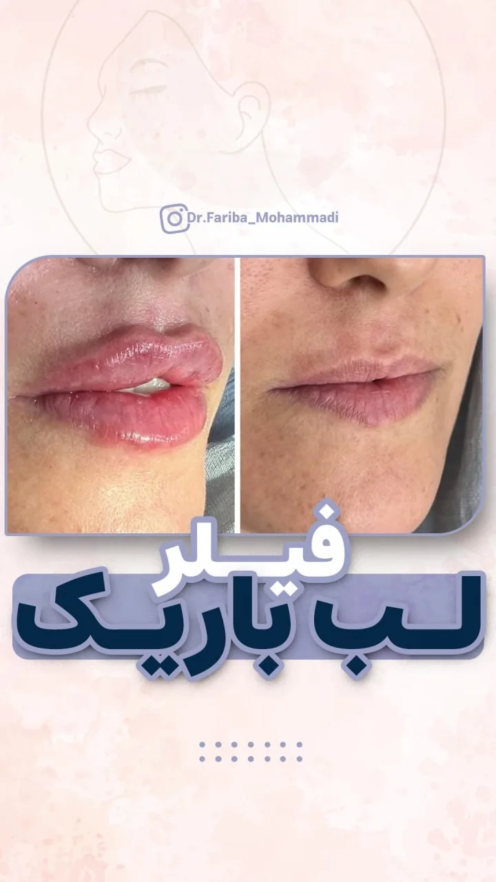 مرکز پوست ،مو و زیبایی دکتر فریبا محمدی - تصویر 4
