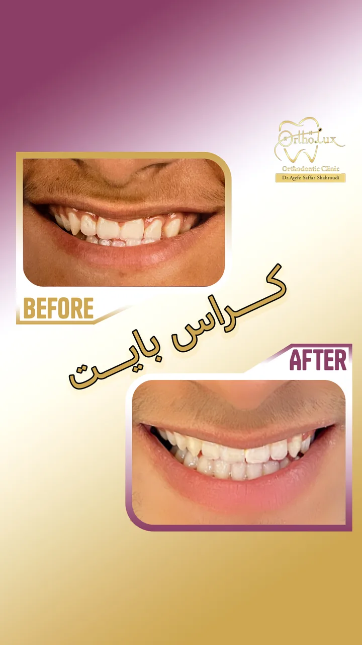 متخصص ارتودنسی دکتر عاطفه صفار شاهرودی - تصویر 2