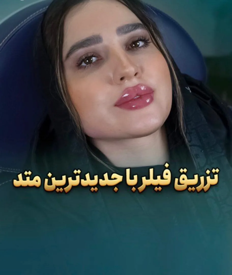 مرکز لیزر  و مطب زیبایی آرو - تصویر 2