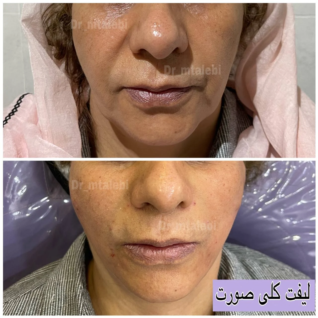 کلینیک زیبایی پوست و مو دکتر مهشید طالبی - تصویر 2