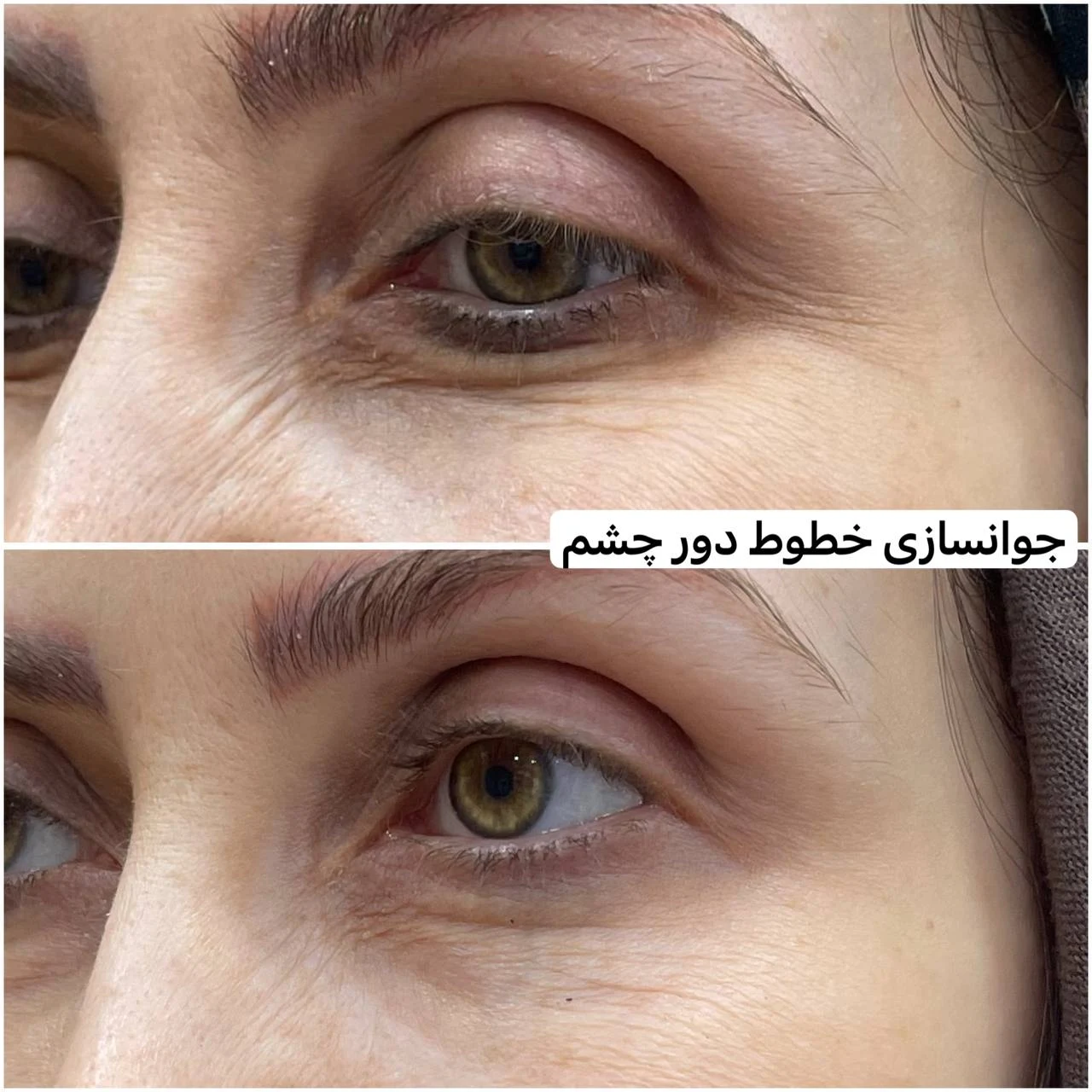 کلینیک زیبایی پوست و مو دکتر مهشید طالبی - تصویر 4