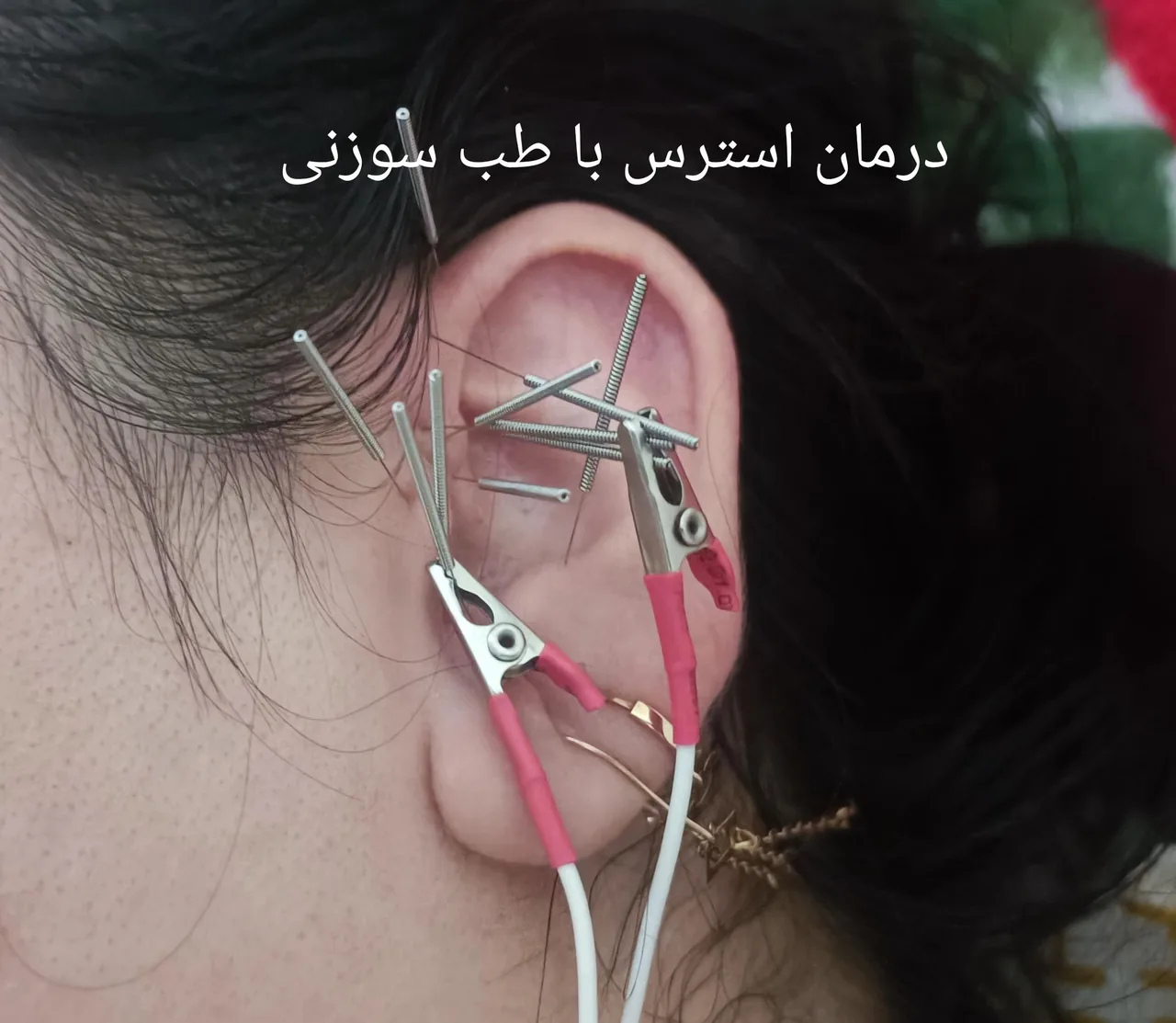 مرکز طب سوزنی دکتر ابراهیم فهیمی