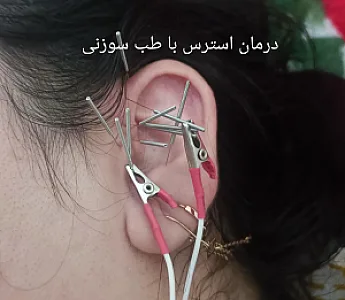 مرکز طب سوزنی دکتر ابراهیم فهیمی