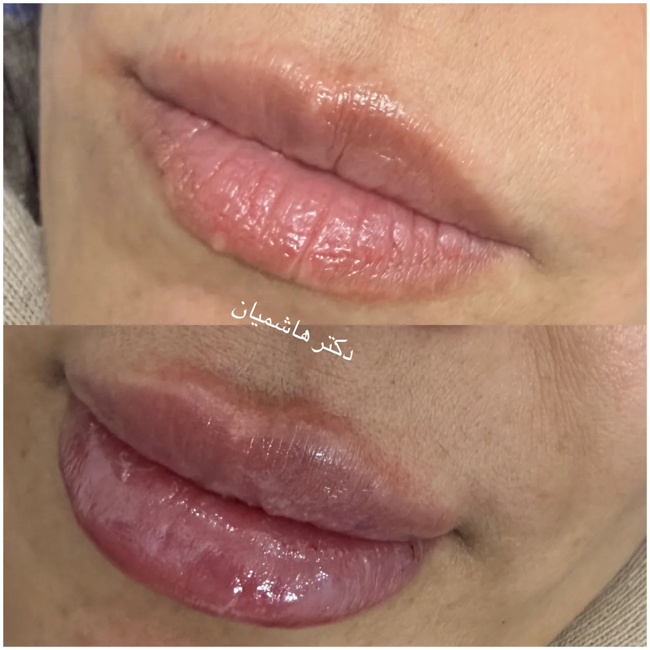 مطب دکتربهنازهاشمیان - تصویر 4