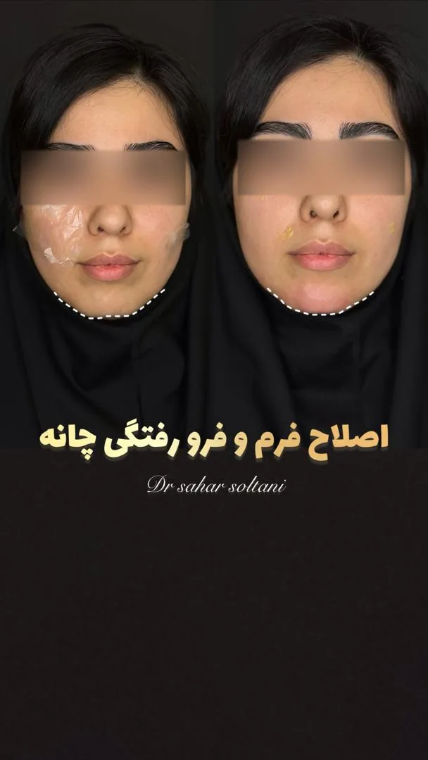 کلینیک زیبایی دکتر سحر سلطانی - تصویر 4