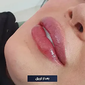 مرکز زیبایی دکتر طرزی