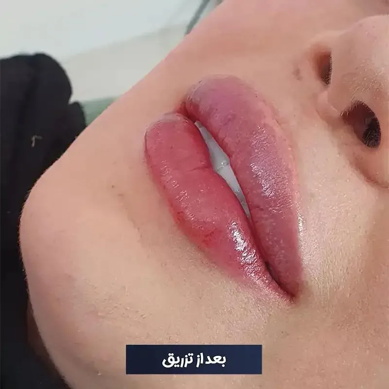 مرکز زیبایی دکتر طرزی