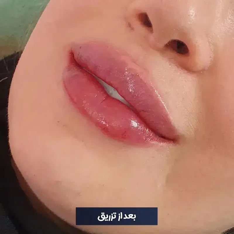 مرکز زیبایی دکتر طرزی - تصویر 2