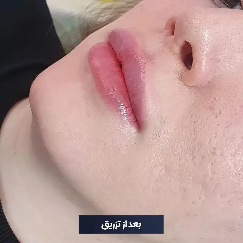 مرکز زیبایی دکتر طرزی - تصویر 3