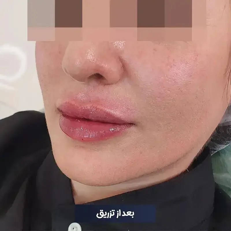 مرکز زیبایی دکتر طرزی - تصویر 4