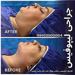 کلینیک تخصصی جراحی بوکال فت دکتر یاسر حریری