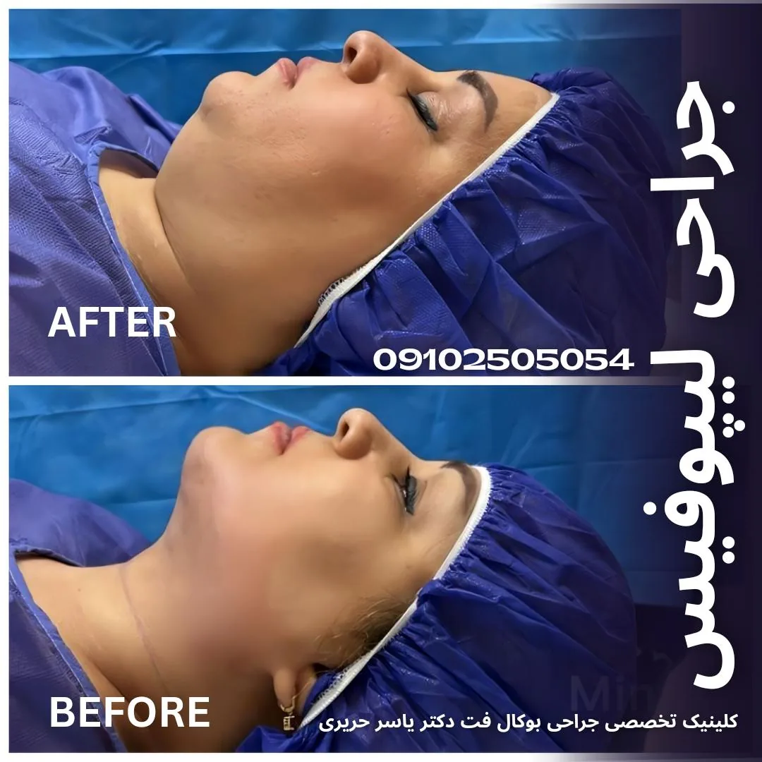 کلینیک تخصصی جراحی بوکال فت دکتر یاسر حریری