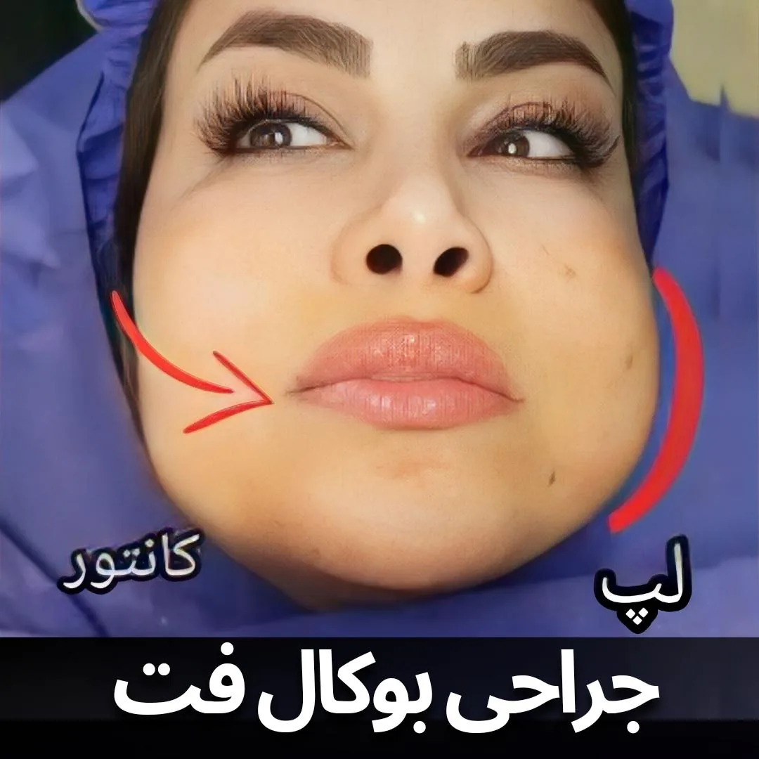 کلینیک تخصصی جراحی بوکال فت دکتر یاسر حریری - تصویر 2