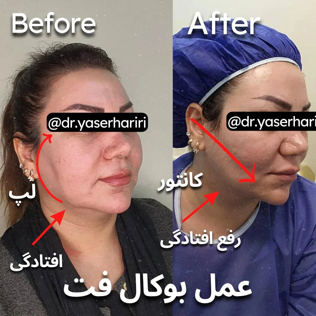 کلینیک تخصصی جراحی بوکال فت دکتر یاسر حریری - تصویر 3