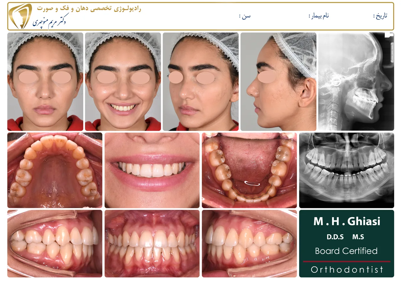رادیولوژی دهان و دندان و فک و صورت دکتر مریم منوچهری - تصویر 3