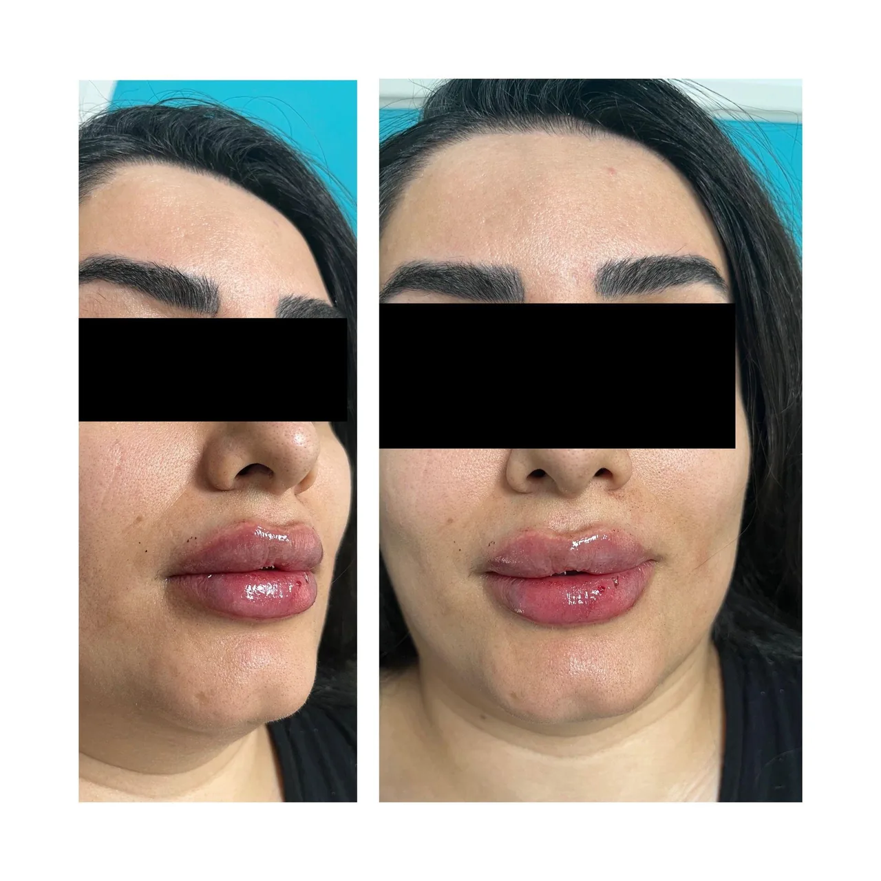 مطب پوست مو زیبایی اسکین ناین - تصویر 2
