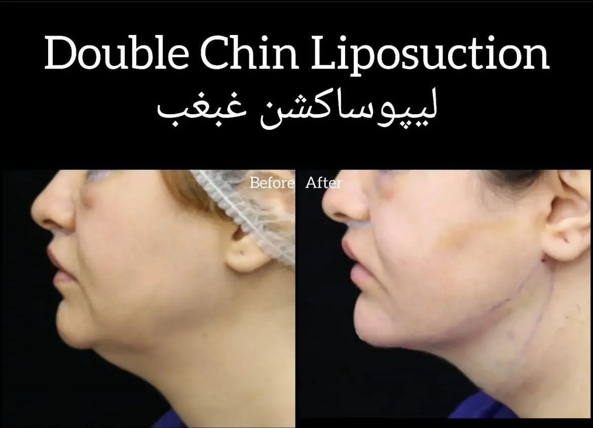 مطب پوست مو زیبایی اسکین ناین - تصویر 4