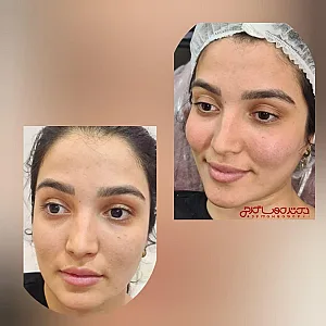 کلینیک پوست،مو،زیبایی دکتر مهسا گرجی