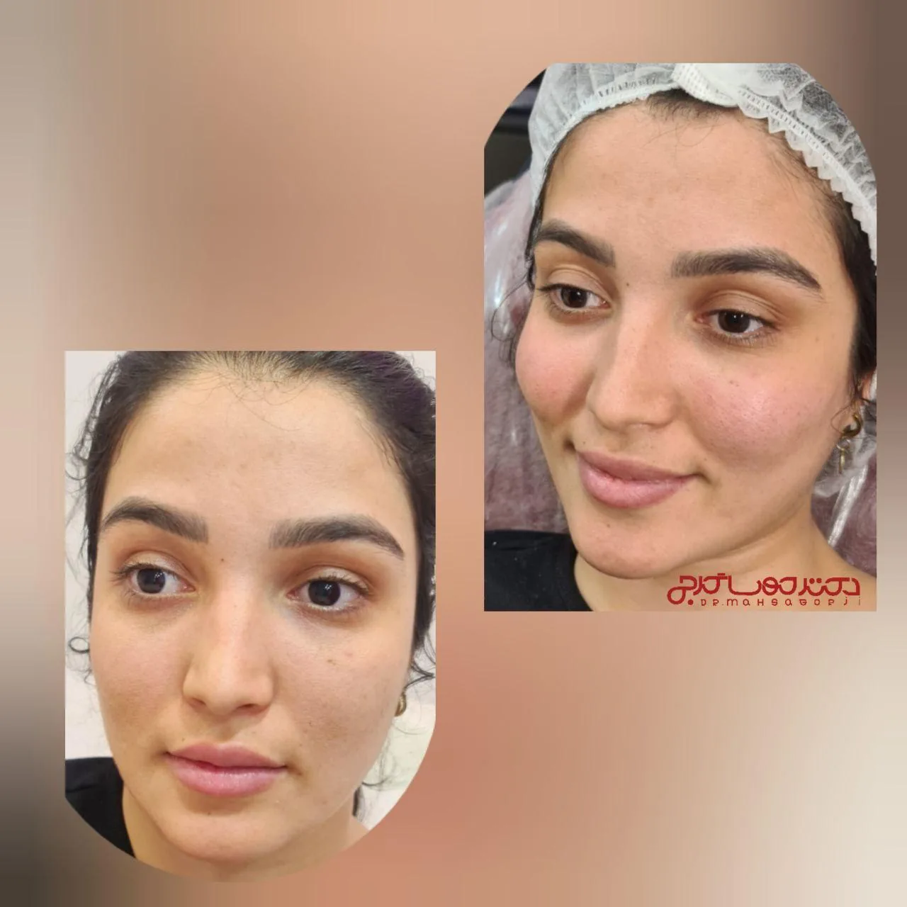 کلینیک پوست،مو،زیبایی دکتر مهسا گرجی