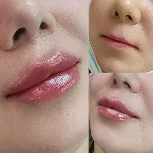 مطب پوست و زیبایی فرمانیه