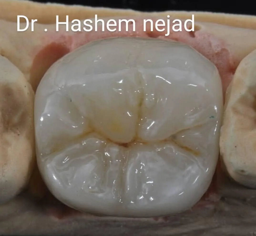 کلینیک دندانپزشکی دکتر هاشم نژاد - تصویر 2
