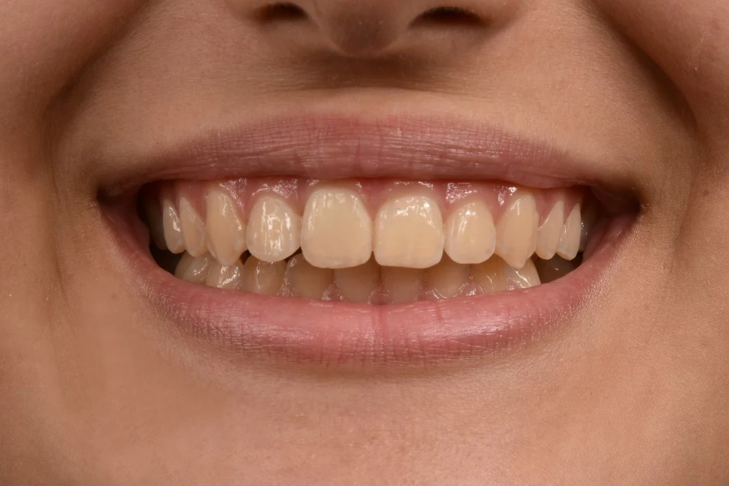 مطب ارتودنسی دکتر صبا صفرزاده - تصویر 3