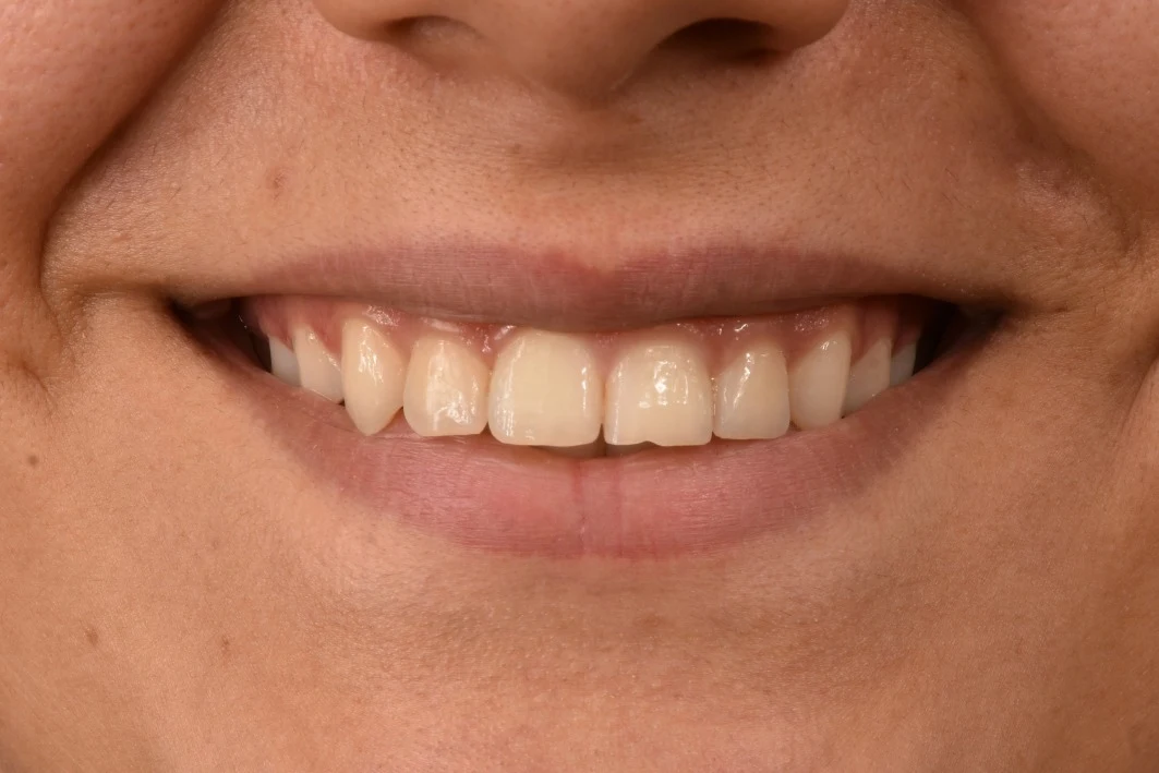 مطب ارتودنسی دکتر صبا صفرزاده - تصویر 4