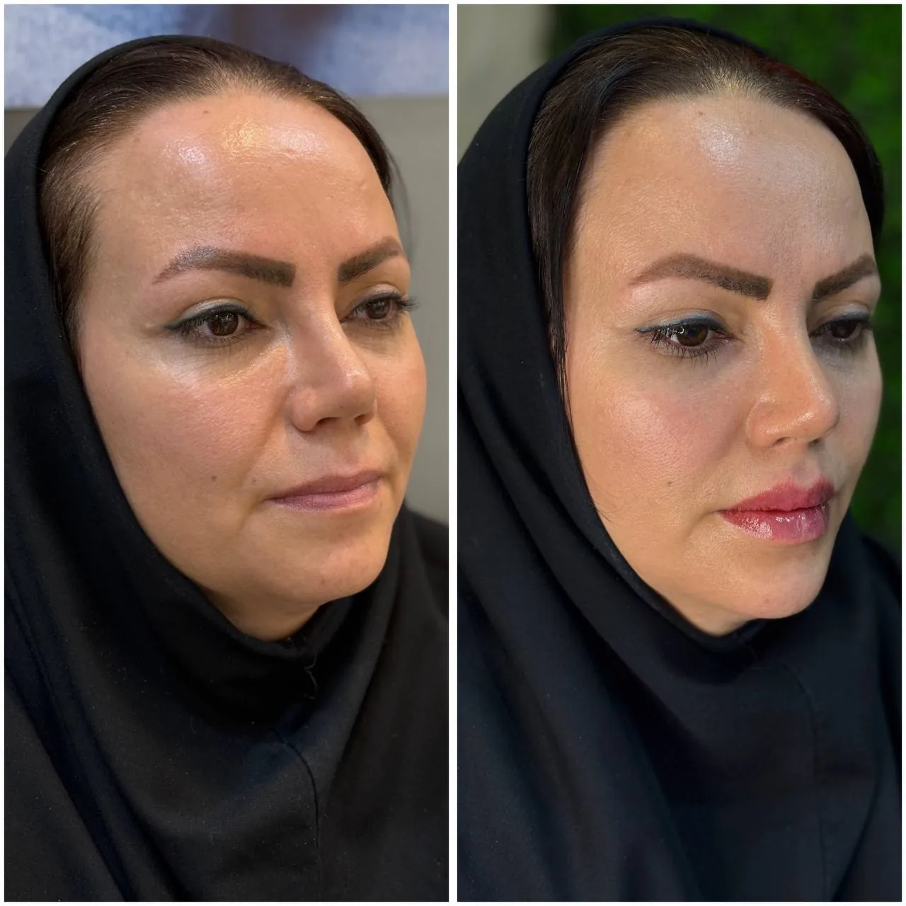 مطب زیبایی لیانارخ - تصویر 2