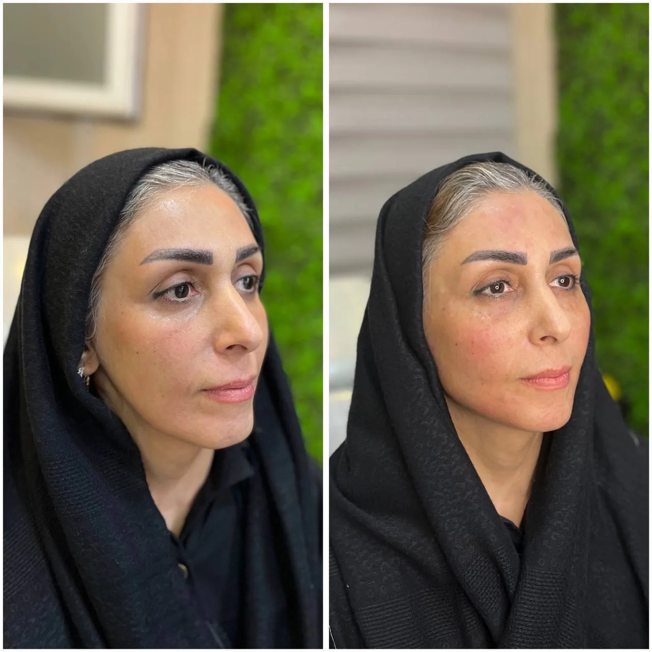 مطب زیبایی لیانارخ - تصویر 3