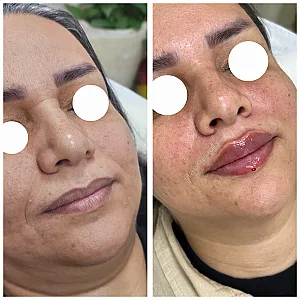 مطب زیبایی دکترمهسا رحیمی