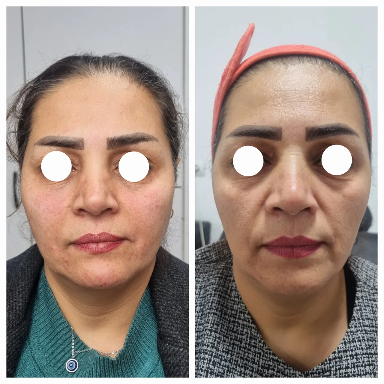 مطب زیبایی دکترمهسا رحیمی - تصویر 2