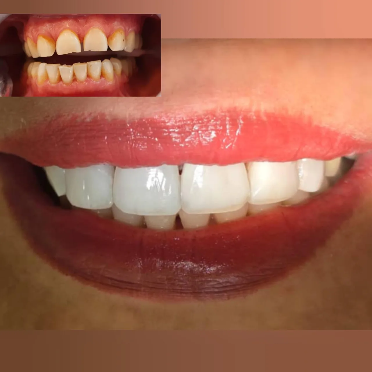 مطب دندانپزشکی دکتر فلاح - تصویر 4