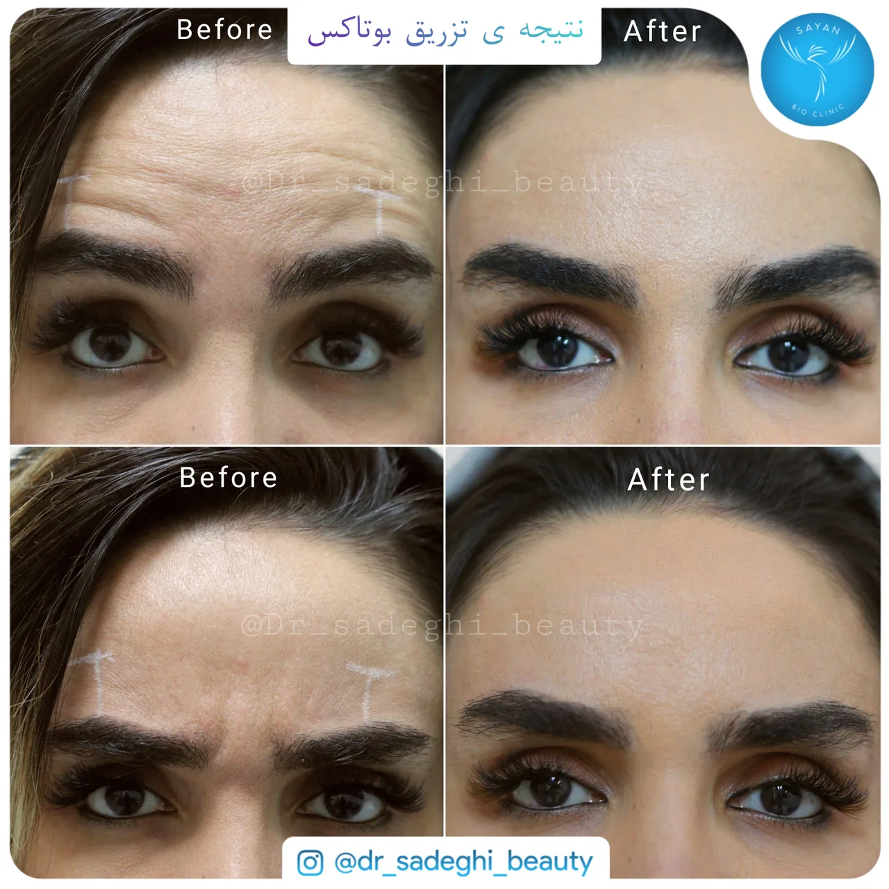 مرکز زیبایی و لیزر دکتر صادقی - تصویر 4