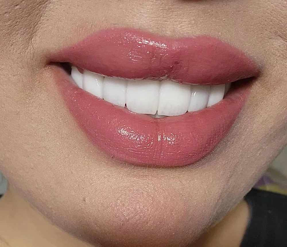 پروتز گوزل گولوش