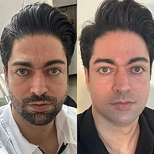 کلینیک تخصصی هایفوآراف فرکشنال لاویش