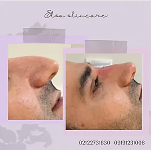 مرکز پوست و مو و لیزر السا