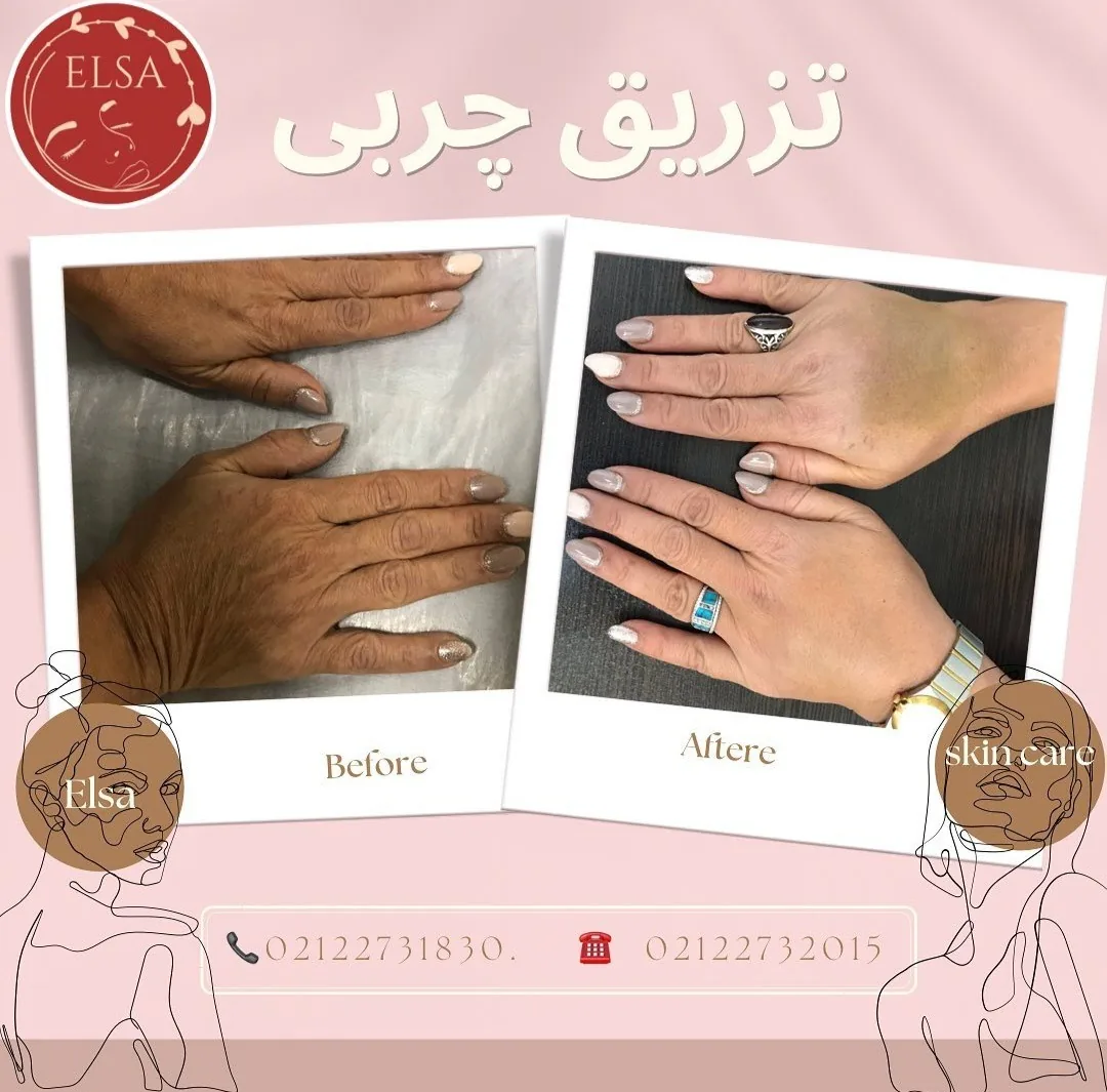 مرکز پوست و مو و لیزر السا - تصویر 3