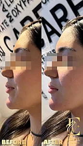 کلینیک زیبایی اریکا(پوست مو لیزر)