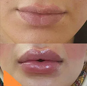 مرکز لیزر و کلینیک زیبایی دلارا