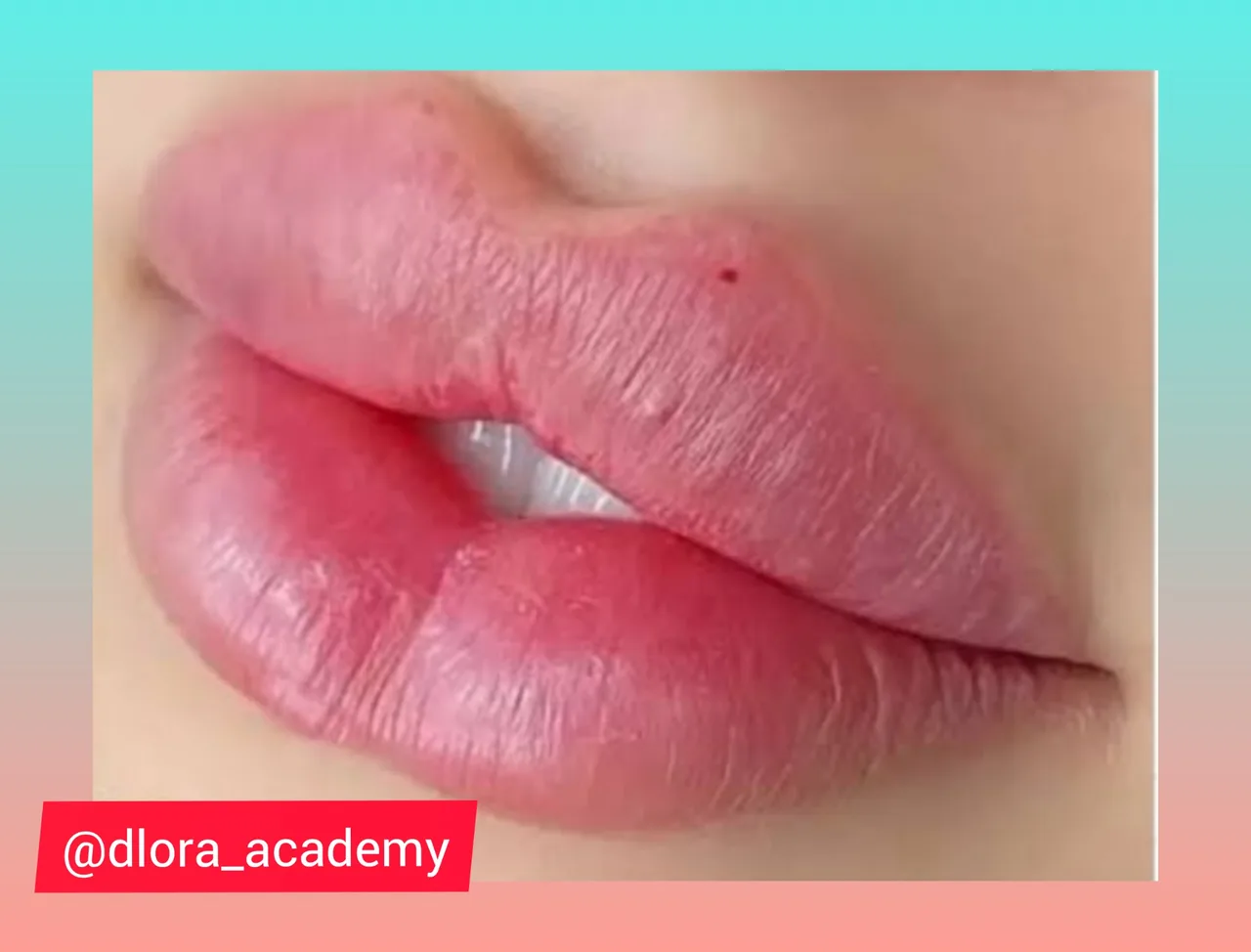مرکز لیزر و کلینیک زیبایی دلارا - تصویر 2