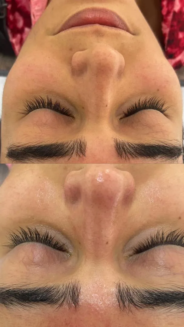 پاکسازی پوست و فیشال تخصصی فریال - تصویر 2