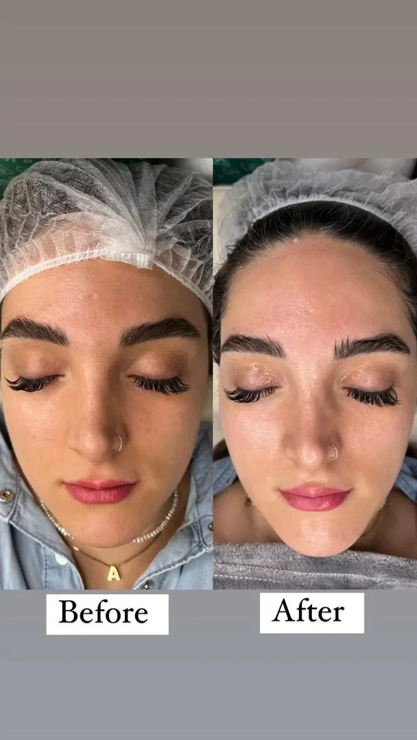پاکسازی پوست و فیشال تخصصی فریال - تصویر 3