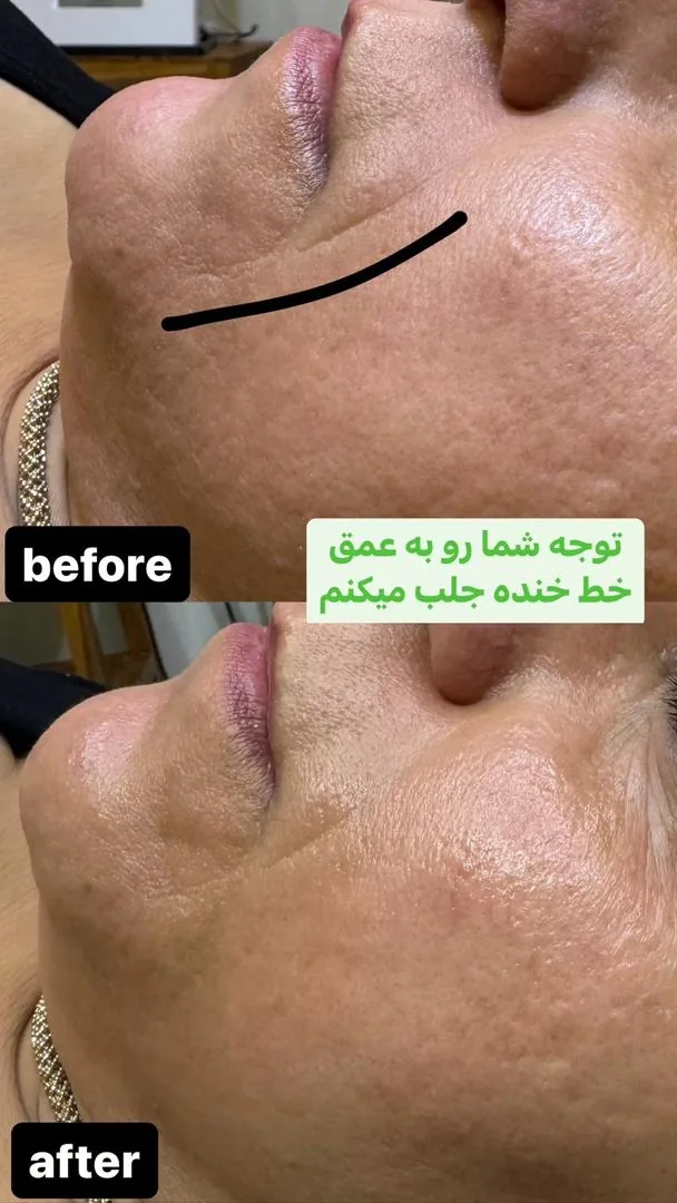 پاکسازی پوست و فیشال تخصصی فریال - تصویر 4