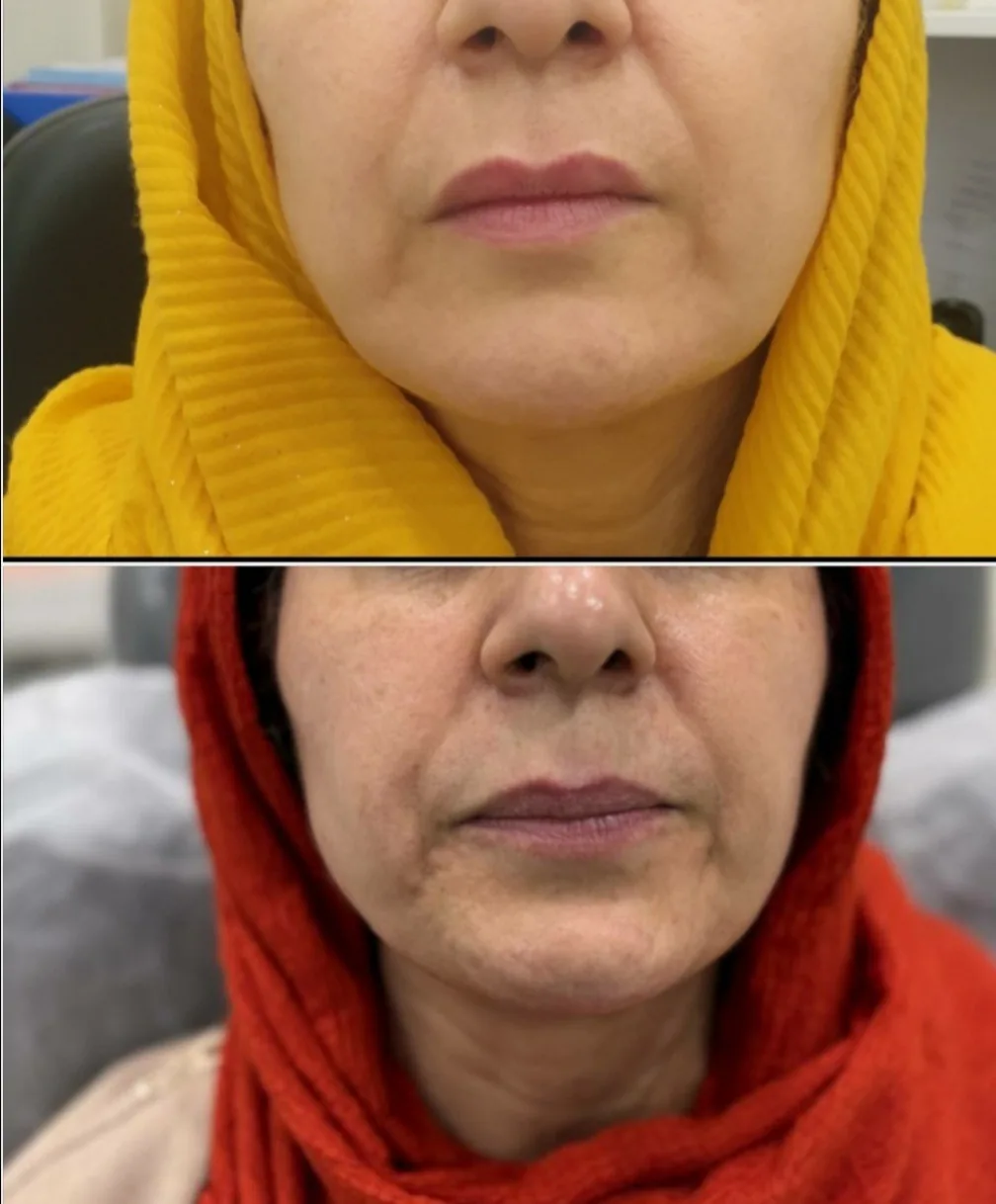 مرکز لیزرو کلینیک زیبایی طراوت - تصویر 2